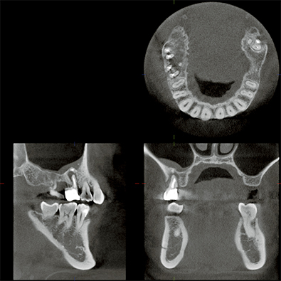 歯科用CT導入